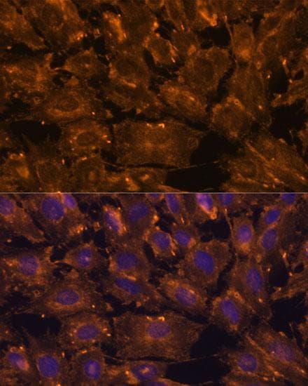 SCGB3A2 Antibody
