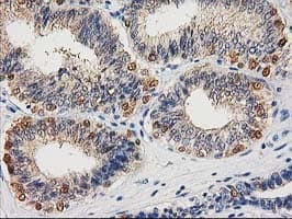 CTH / Cystathionase Antibody (clone OTI1E12, Carrier-free)
