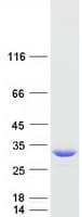 Human 15-PGDH / HPGD Protein (Recombinant Myc-DDK (Flag))