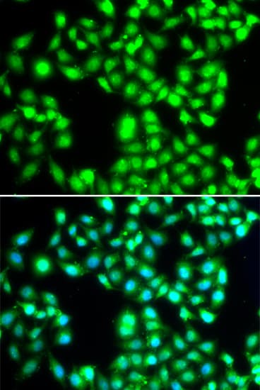 YTHDC1 Antibody