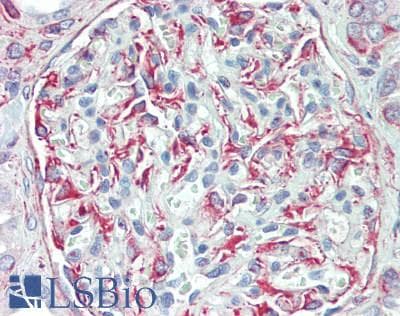 IHC-plus™ Polyclonal Rabbit anti-Human GPSM2 / LGN Antibody (aa627-677, IHC, WB)