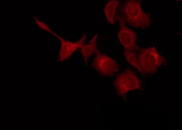 Polyclonal Rabbit anti-Human KISS1 / Kisspeptin / Metastin Antibody (IHC, IF, WB)