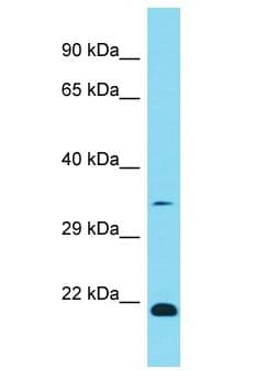 Polyclonal Rabbit anti-Human OR1K1 Antibody (aa242-291, WB)