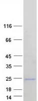 Human ARL5A / ARL5 Protein (Recombinant Myc-DDK (Flag))