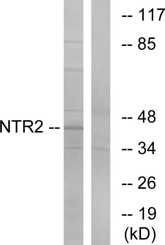Polyclonal Rabbit anti-Human NTSR2 / NTR2 Antibody (aa151-200, IF, WB)