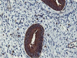 PFKP Antibody (clone OTI5F7)