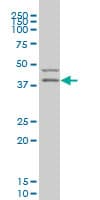 IHC-plus™ PDK2 Antibody (clone 2G1)