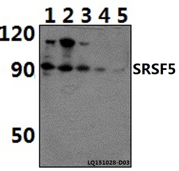 Polyclonal Rabbit anti-Human SRSF5 / SFRS5 Antibody (WB)