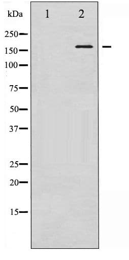 KDR / VEGFR2 / FLK1 Antibody (phospho-Tyr1059)