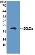 CEA / Carcinoembryonic Antigen Antibody (aa544-771, APC)