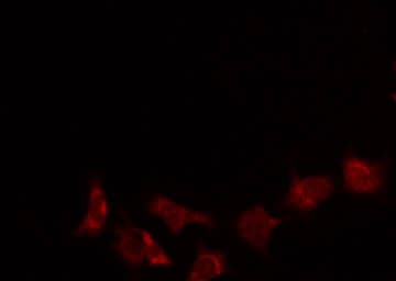 SCLIP / STMN3 Antibody