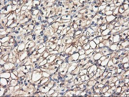 TUBAL3 Antibody (clone OTI1C2)