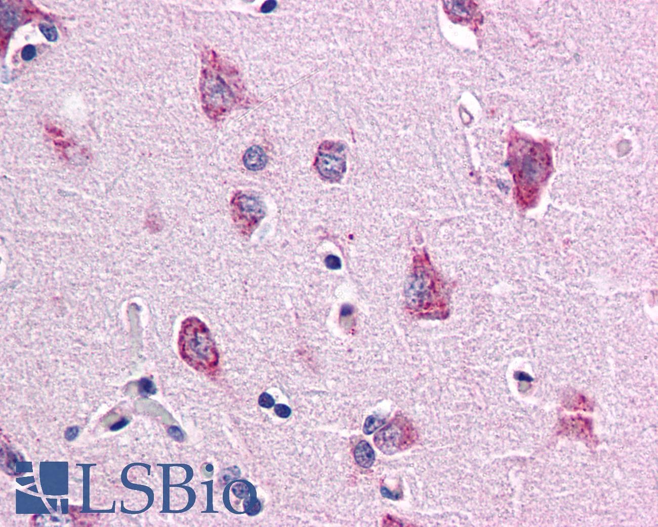 IHC-plus™ TM9SF4 Antibody (Internal)