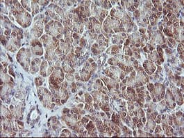 MAP2K3 / MEK3 / MKK3 Antibody (clone OTI6B12)