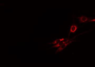 CPM / Carboxypeptidase M Antibody
