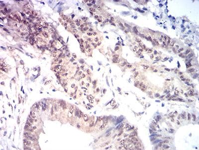 Monoclonal Mouse anti-Human MYST2 / HBO1 Antibody (clone 1D9H9, IHC, WB)