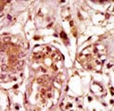 Polyclonal Rabbit anti-Human BUB1 Antibody (aa1043-1073, IHC, WB)