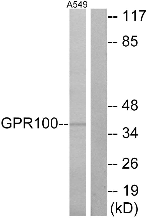 Polyclonal Rabbit anti-Human RXFP4 / GPR100 Antibody (aa321-370, IF, WB)