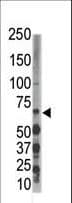 DYRK3 Antibody (aa1-30)