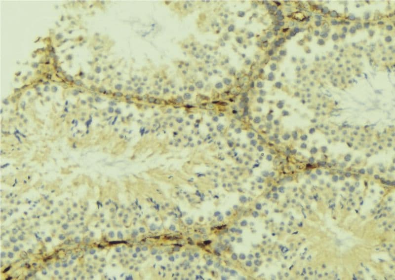 Polyclonal Rabbit anti-Human MAP1LC3B / LC3B Antibody (IHC, IF, WB)