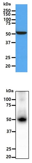 ALDH5A1 Antibody (clone AT17F5)