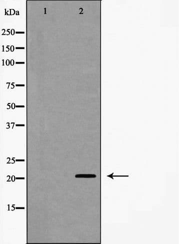 Polyclonal Rabbit anti-Human TTF / RHOH Antibody (IF, WB)