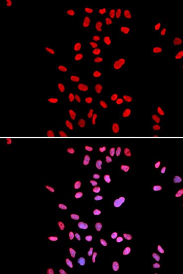 Polyclonal Rabbit anti-Human DKC1 / Dyskerin Antibody (IHC, IF, WB)