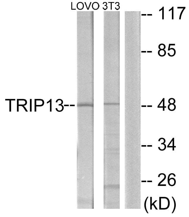 TRIP13 Antibody