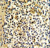 DCXR Antibody (aa79-106)