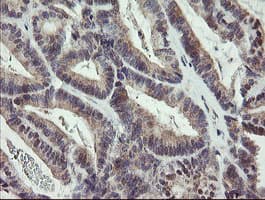 Monoclonal Mouse anti-Human ZBED1 / TRAMP Antibody (clone OTI2E5, IHC, WB)
