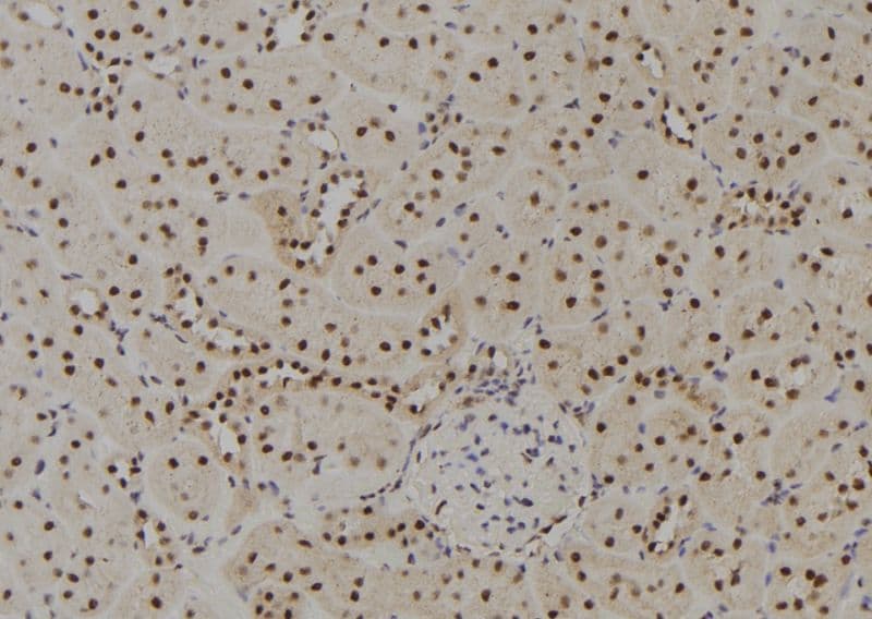 GTF2H4 / TFB2 Antibody