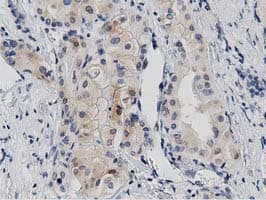 PRKD2 / PKD2 Antibody (clone OTI4F1)