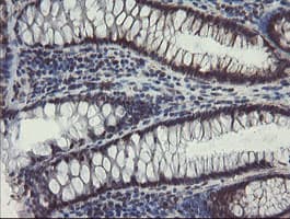 SKIL / SNO / SnoN Antibody (clone OTI1A6)