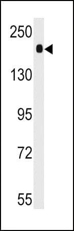 ACE / CD143 Antibody (aa1274-1306)