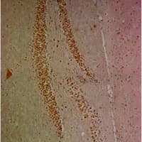 RELA / NFKB p65 Antibody