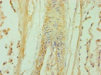 Polyclonal Rabbit anti-Human BAMBI Antibody (aa21-152, IHC)
