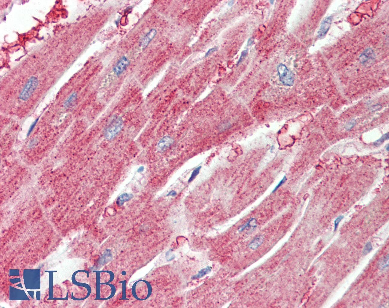 IHC-plus™ ARPC1A Antibody (aa356-368)