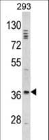 Polyclonal Rabbit anti-Human DLX2 Antibody (aa194-222, IHC, WB)