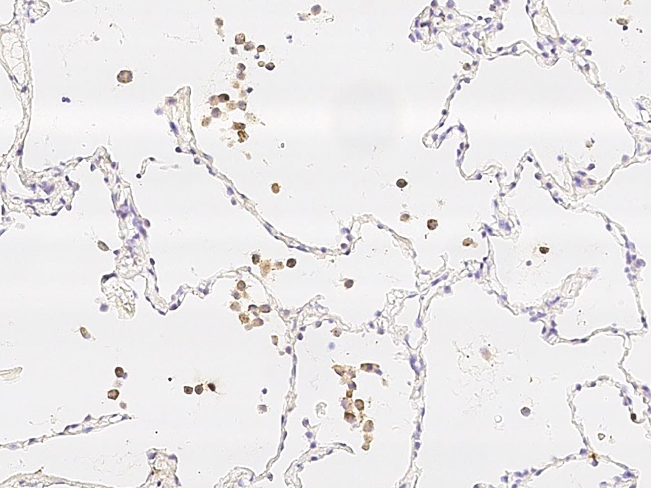 Monoclonal Mouse anti-Human IL-1B / IL-1 Beta Antibody (clone 39, Preservative Free, IHC)
