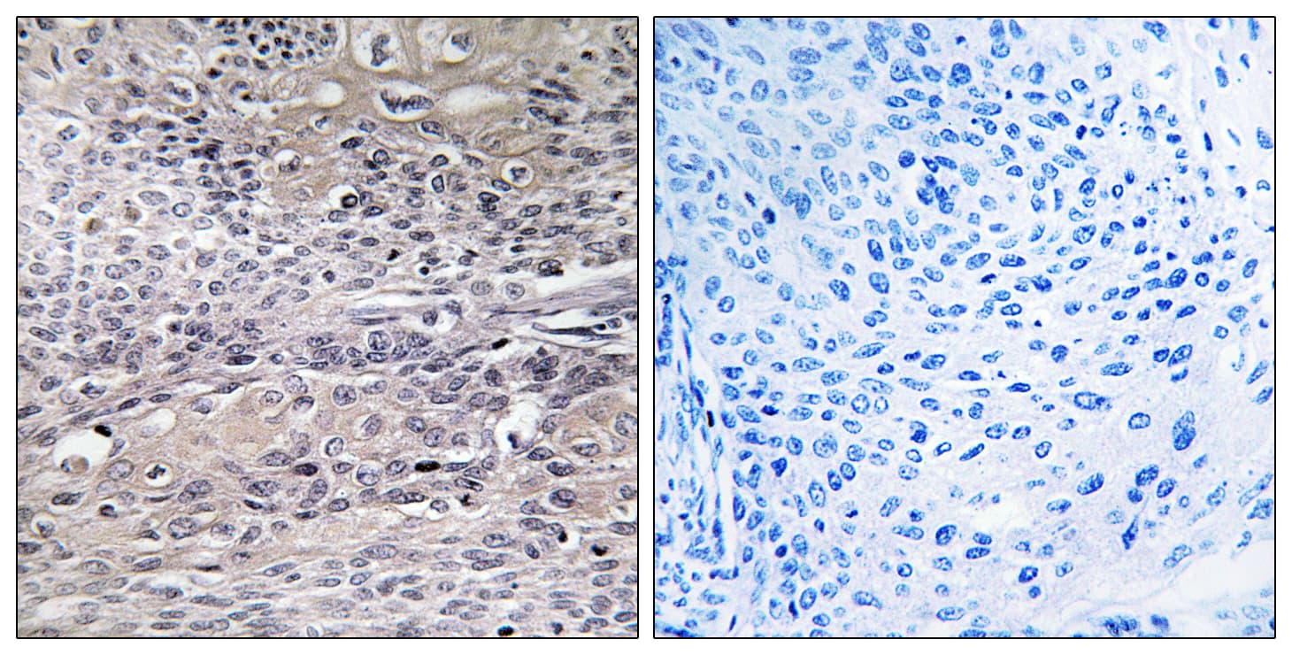 ACO1 / Aconitase Antibody (aa681-730)