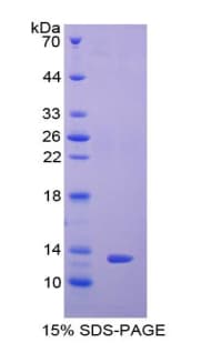 Rat PIGR Protein (Recombinant His)