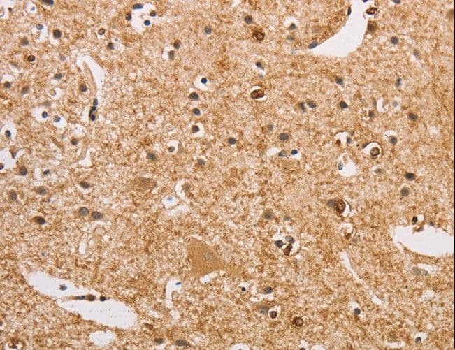 ARHGEF5 Antibody