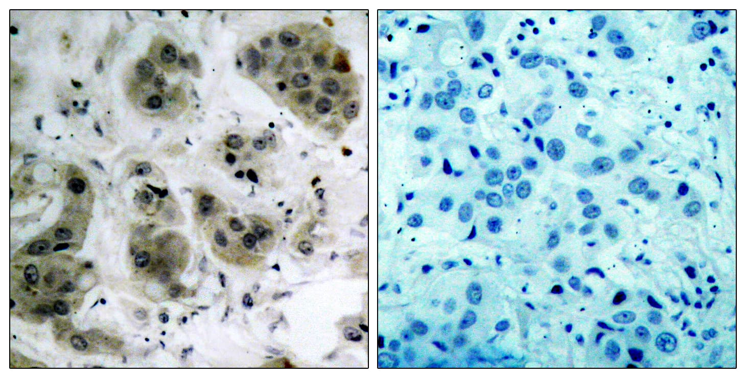 AKT1 + AKT2 + AKT3 Antibody (aa431-480)