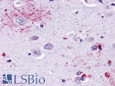 PathPlus™ Polyclonal Rabbit anti-Human MAS1 / MAS Antibody (C-Terminus, IHC)