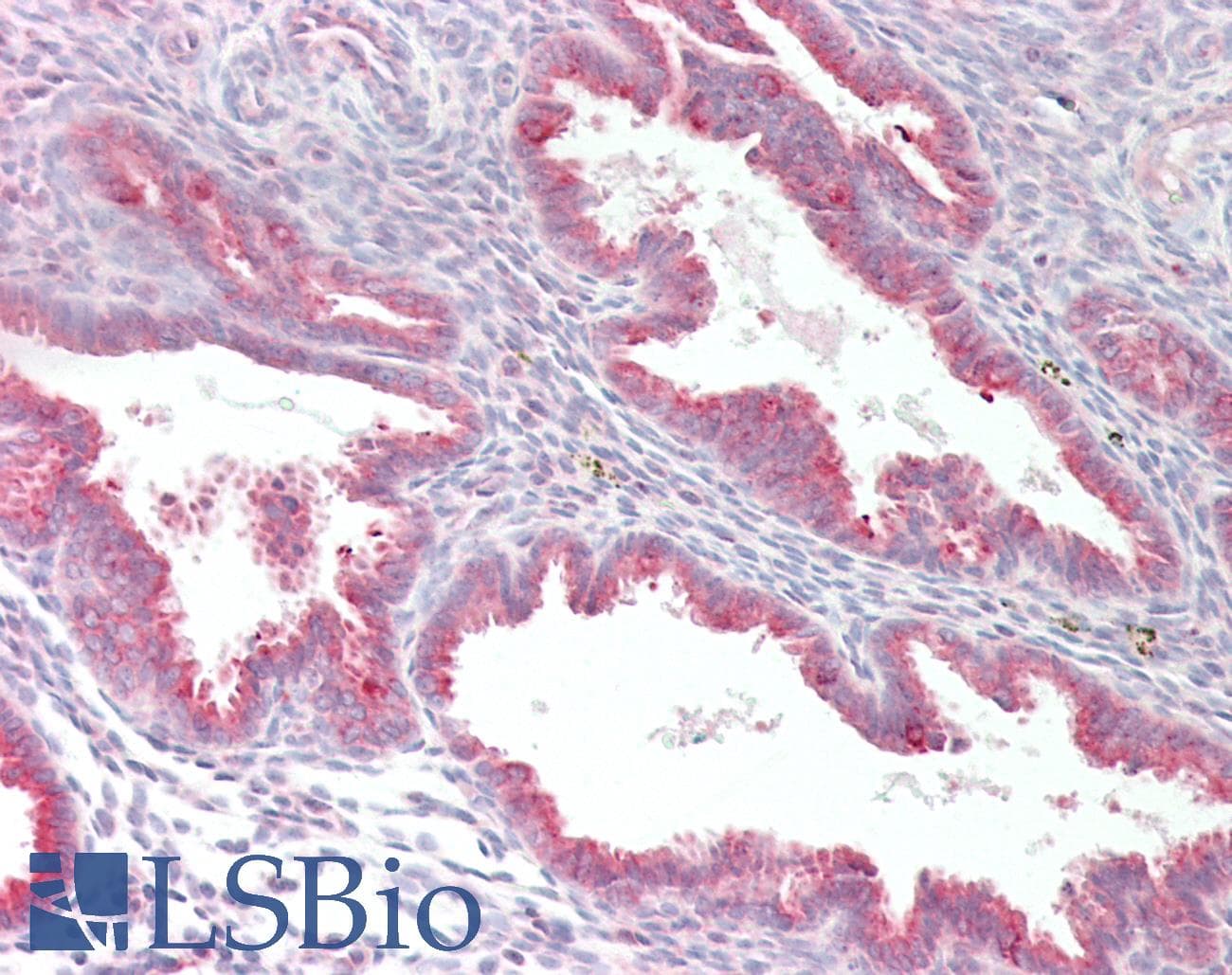IHC-plus™ MYF5 / MYF 5 Antibody (aa7-36)