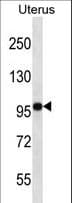 FGD4 Antibody (aa157-186)