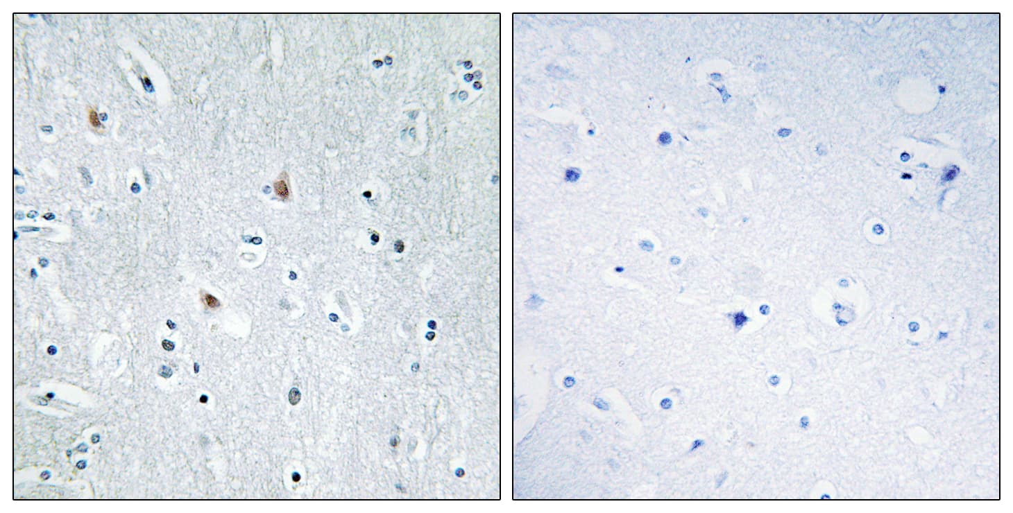 Polyclonal Rabbit anti-Human SOX12 Antibody (aa71-120, IHC)