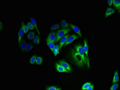 Polyclonal Rabbit anti-Human KCNK13 / THIK-1 Antibody (IHC, WB)