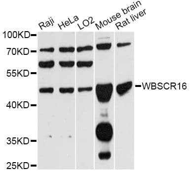 Polyclonal Rabbit anti-Human WBSCR16 Antibody (WB)