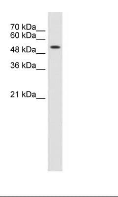 PathPlus™ KRT8 / CK8 / Cytokeratin 8 Antibody (N-Terminus)